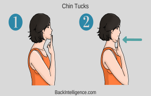Chin Tuck Example